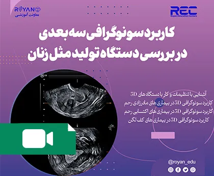 888 کارگاه کاربرد سونوگرافی سه بعدی در بررسی دستگاه تولید مثل زنان